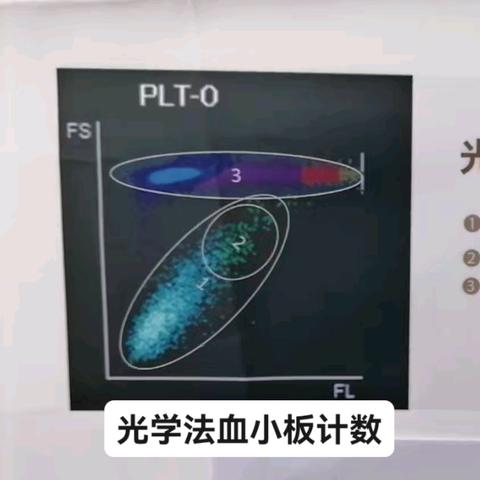 一例新生儿溶血病患者血小板计数变化分析