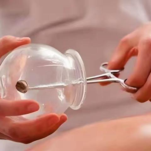 针罐除病痛，更疗人心：中医病房里的“叙事治愈力”