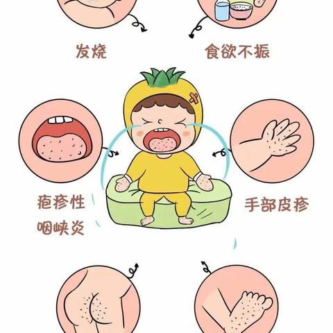 科学预防，守护健康！ 上幼预防手足口健康知识宣传