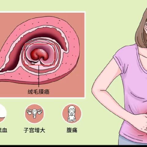 湖北省妇幼保健院   妇II吴彬的文章