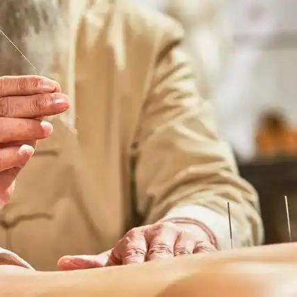 带状疱疹后遗神经痛的“随性”针法