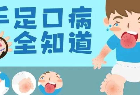 手足口预防护理第三幼儿园健康教育主题活动