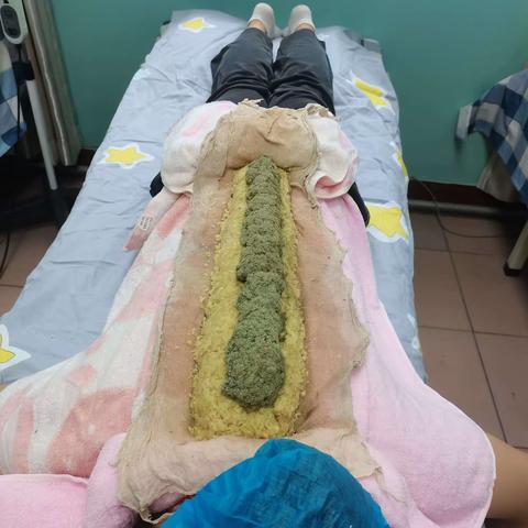 督脉灸：灸一脉而通全身——嘉峪关市中医医院针灸推拿科