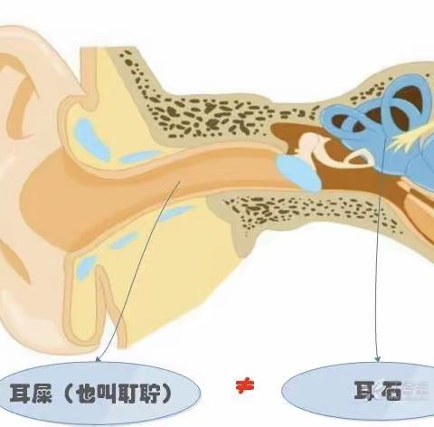 常见眩晕【耳石症-一石激起千层浪】定陶区中医医院急诊内科（神经内科）