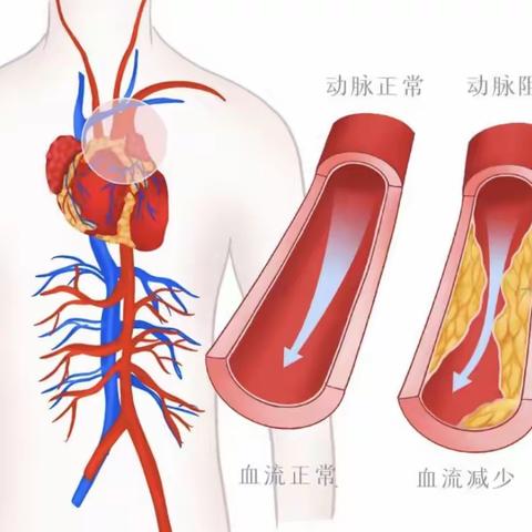 做好这些事，血管老得慢