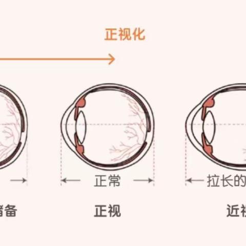 预防近视保护视力