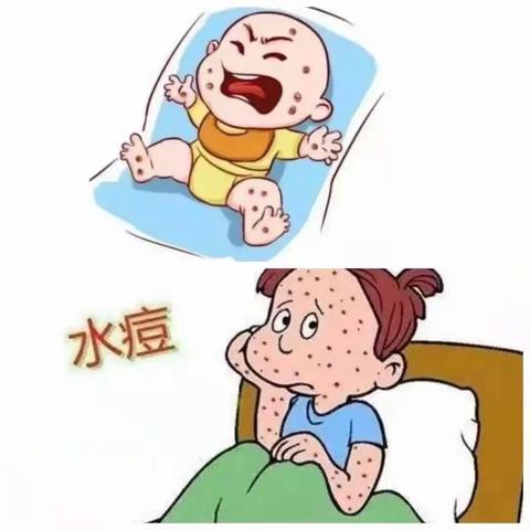 【朗文幼儿园】“知水痘 防水痘”——幼儿园预防水痘知识宣传