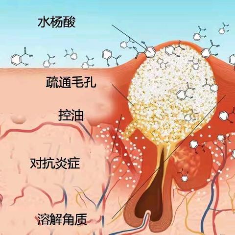 正确认识水杨酸