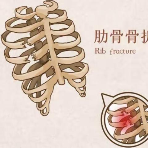 庄里医院外科健康科普——肋骨骨折