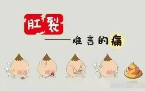健康科普之肛裂