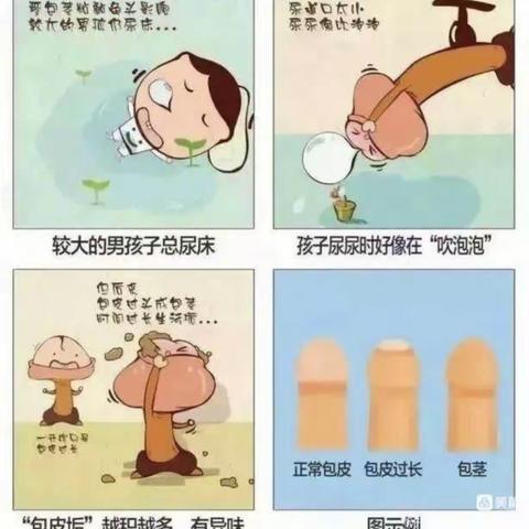 割包皮要趁“热”，暑期包皮手术黄金期，早安排更省心!