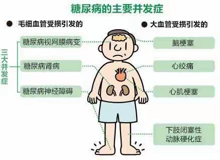 糖尿病科普宣传，附：糖尿病患者健康教育处方