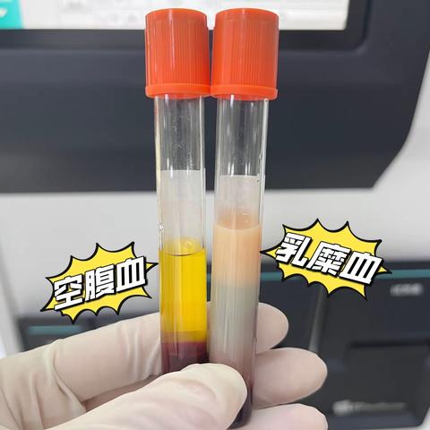 检验科科普知识｜空腹采血