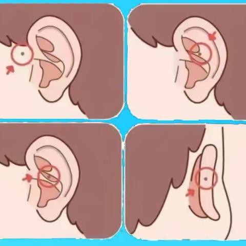 耳朵上的小洞是什么？该如何护理？