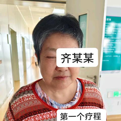 高压氧助力脑出血患者动眼神经损伤恢复