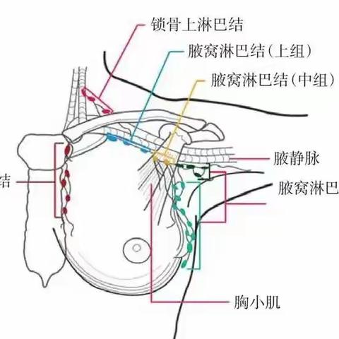 重庆大学附属三峡医院乳腺中心完成渝东北片区首例“左乳腺癌内乳淋巴结清扫手术”