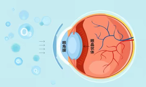 详细带你了解OK镜是什么？品牌又该怎么去选择？