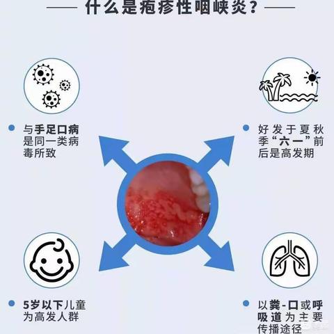 【疱疹性咽峡炎小知识】--青未了幼儿园祥平园、洛平园