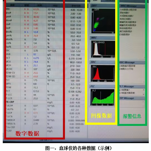 血常规人工镜检那些事