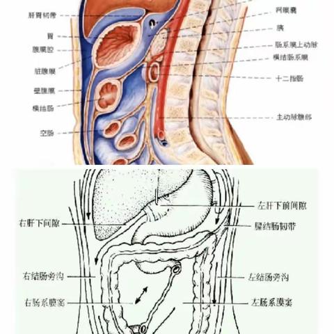 复肿医院学习——腹膜转移性癌特点