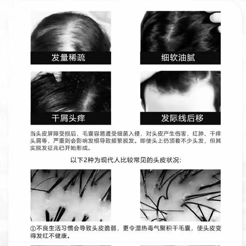 头皮管理，毛囊清洁排毒养护