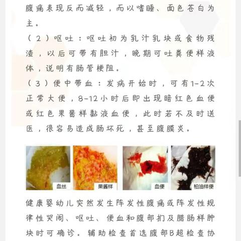 科普宣传：人生无常，“大肠套小肠”——肠套叠