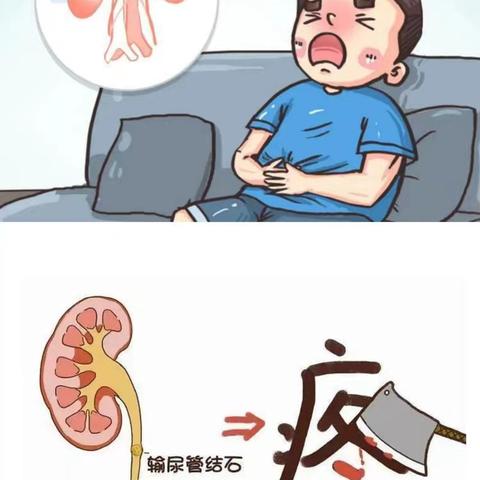 【医学科普】输尿管结石临床治疗与影像学诊断，全面了解输尿管结石！