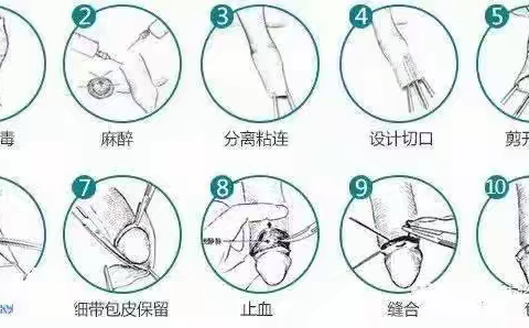 小儿包皮过长及治疗