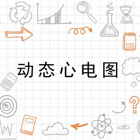 动态心电图