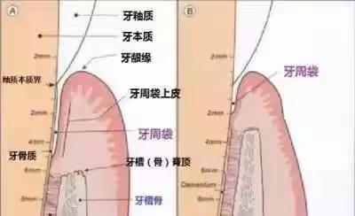 卓维雅口腔早报分享（我要洗牙医生让我做牙周治疗）