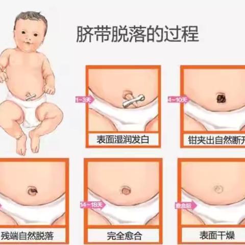宝宝的脐带如何护理？