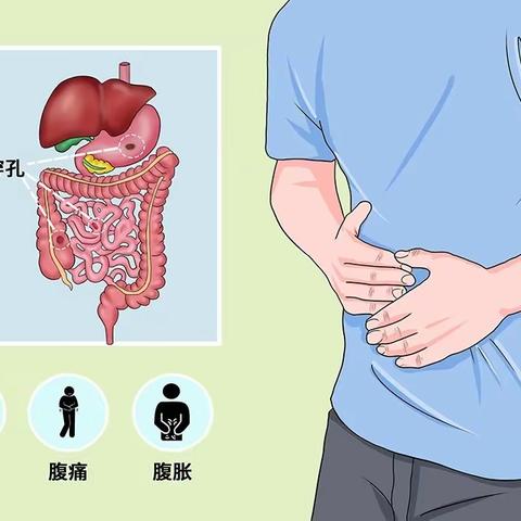 危险的腹痛——消化道穿孔