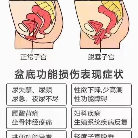 【卢氏县中医院盆底康复中心/女性漏尿病免费检查】