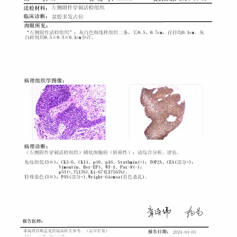 中晚期宫颈癌--中西医结合疗效佳