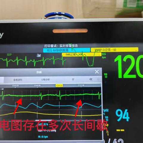 98岁老人的“瞬间恍惚”——心脏发出的致命警报
