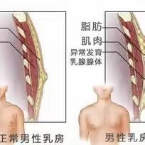 男性乳腺腔镜手术 还男儿坦荡胸怀