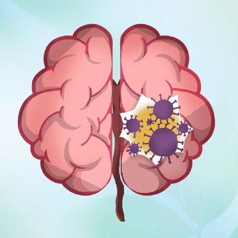 “脑子的感冒”——可大可小的病毒性脑炎