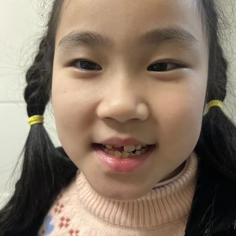 换牙历险记