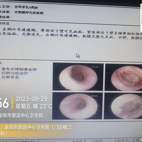 日常部分工作随手记11