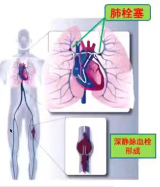 走向临床，建立临床思维之旅之AICU/CCU篇