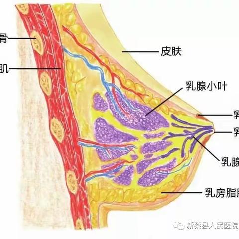 乳腺增生症