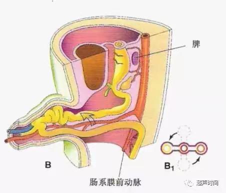 生理性中肠疝的超声特征及鉴别诊断