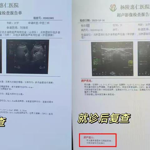 【案例分享】甲状腺结节惹人恼，传统中草药见奇效！