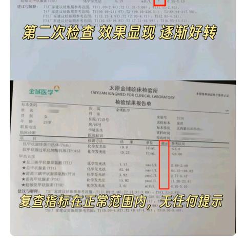 心慌失眠、脱发多汗，甲亢症状百出！国医刘馆长"先控后固"，辨证施治破桥本甲亢