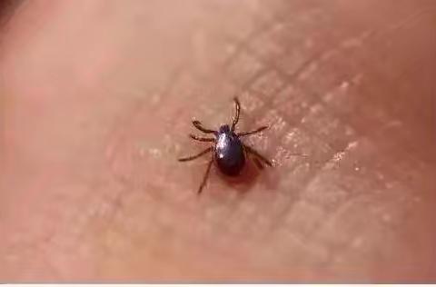 警惕“隐形杀手”蜱虫——重症医学科带你科学应对