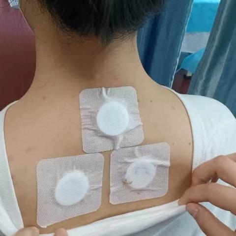 冬病夏治正当时，沙湾镇卫生院2024年三伏贴、督脉灸预约开始啦！