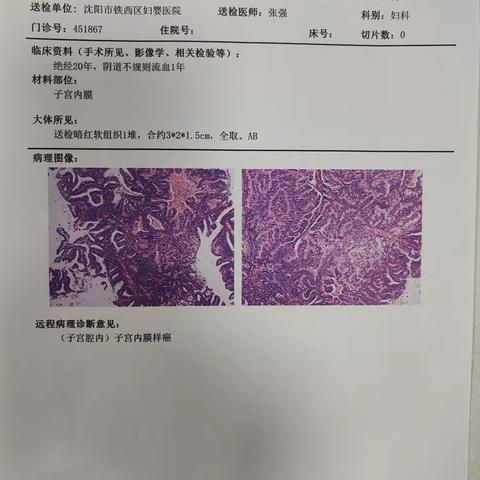 警惕绝经后阴道不规则流血-提高生命质量