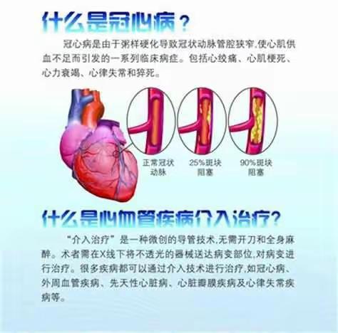 青海康乐医院冠状动脉造影术为广大患者心脏保驾护航