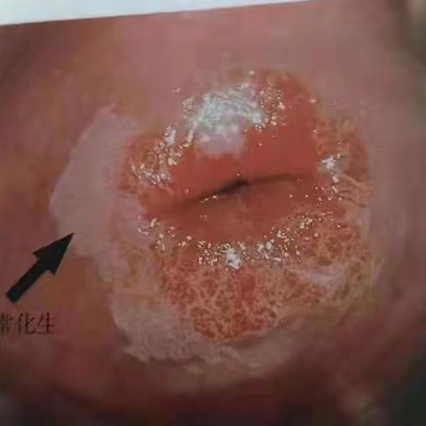 灵丘县中医院妇产科——关于阴道镜的科普知识