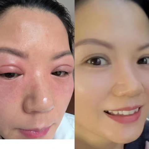 多年的皮肤过敏，从怀疑到体验改变